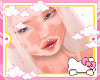 grace vitiligo