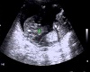 Izzy Ultrasound