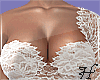 Sensuel Lace Set 1