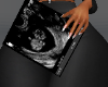Preg 3 Ultrasound