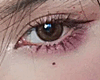 mole under eye