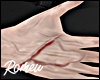 Hands Veins + Scars X