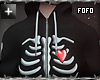 x-ray hoodie