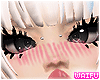 crosseyed !