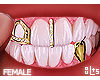 †. F Teeth 61