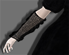net on arm