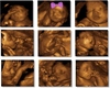 Custom Ultrasound Pics