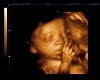 3D  SINGLE BABY POSE