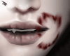 l Kiss