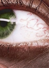 صورة الـavatar