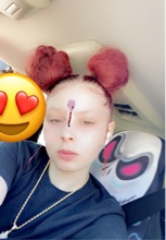 Guest_bracefacenicole2