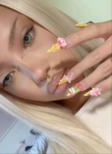 lipfiller