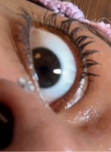 Guest_PatricksToenails
