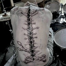 spinalrot