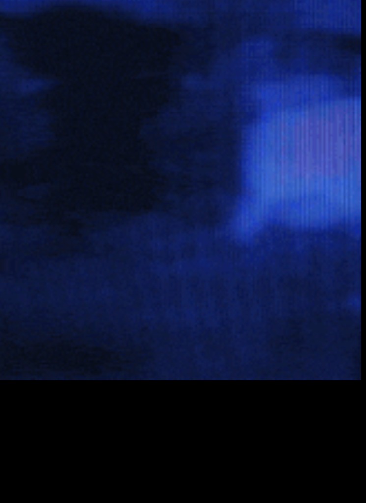 blinker1